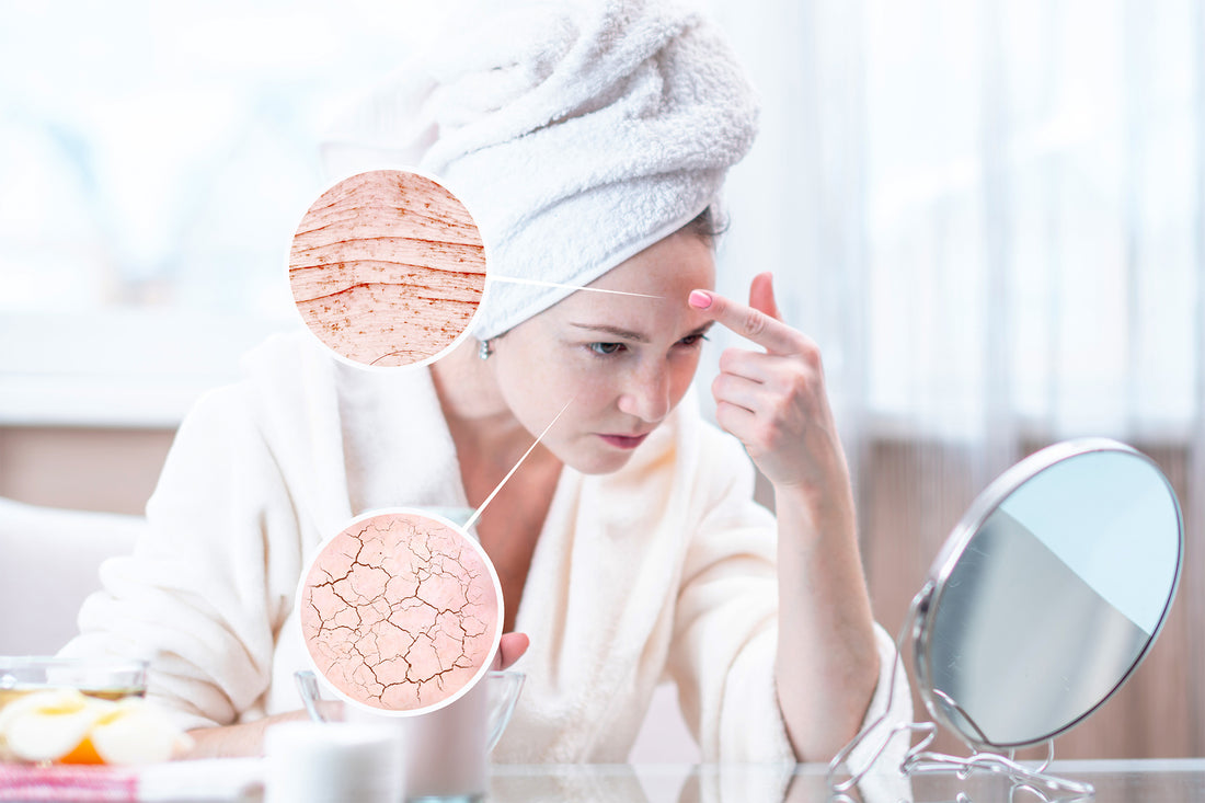 10 keinoa vähentää ihon ja hiusten kuivumista!